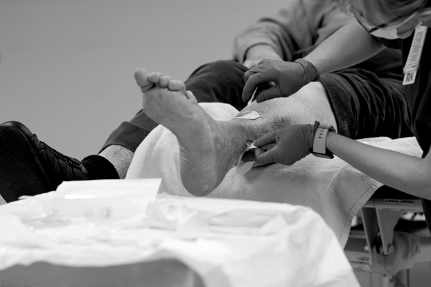 CRH Talk Video: Local Wound Care Treatments