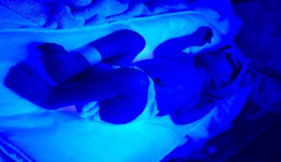 Neonatal Jaundice Management